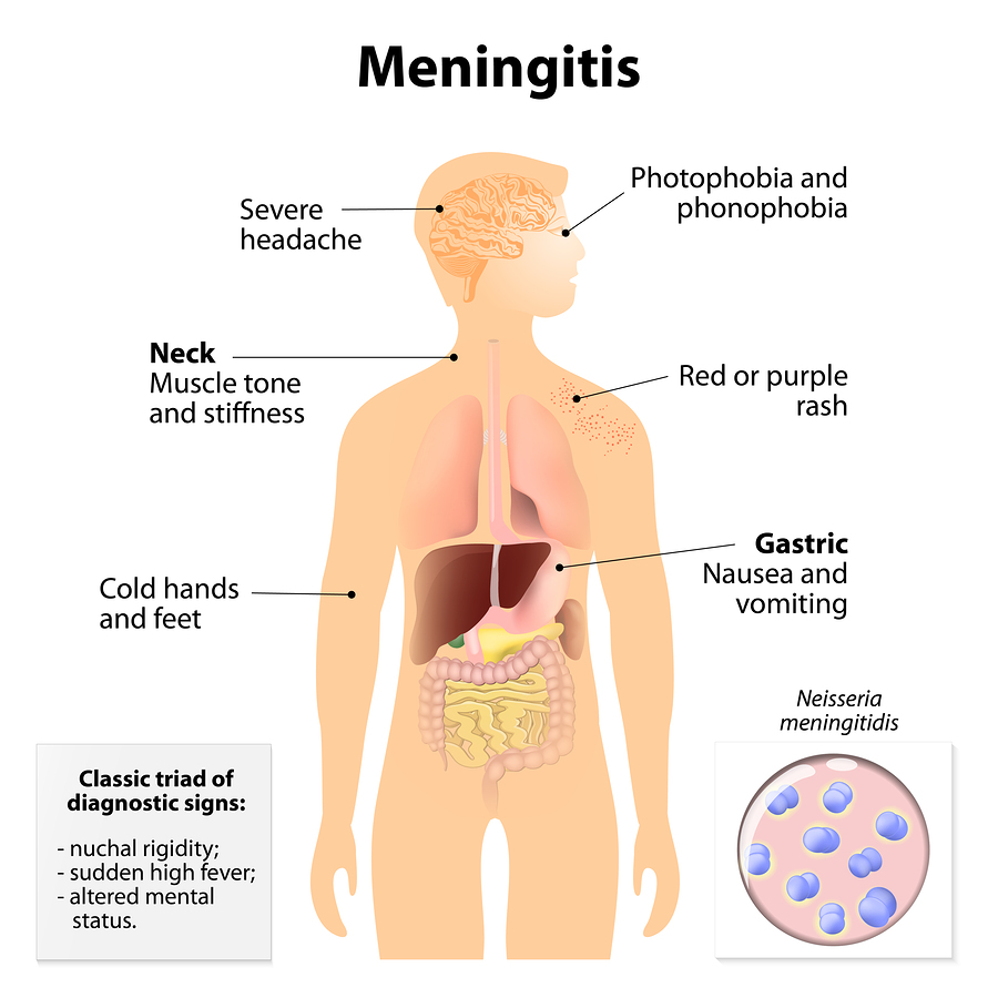 fungal meningitis rash