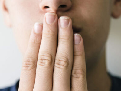 What are Fever Blisters?