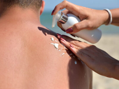 Sunburn & Skin Damage