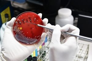 Differences Between Viruses and Bacteria