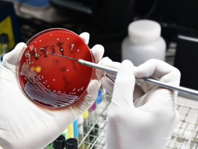 Differences Between Viruses and Bacteria