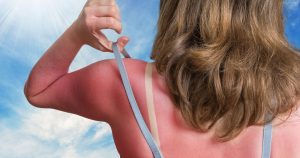 Avoiding Skin Cancer